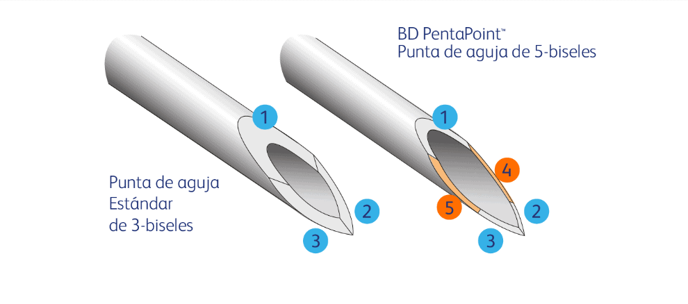 Menor dolor de inserción