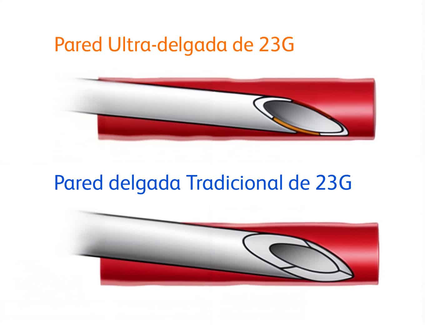 25G vs 23G